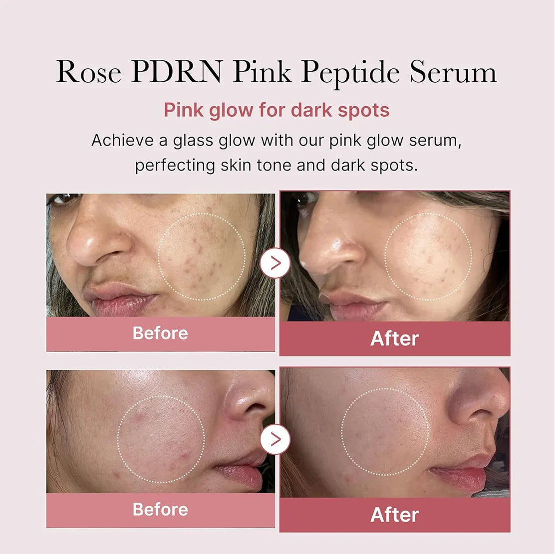 PDRN Pink Peptide Serum 🫧